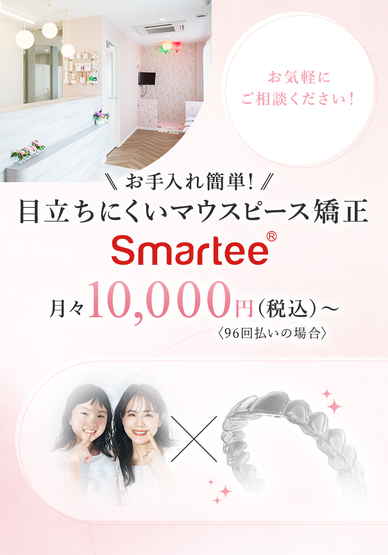 お手入れ簡単!目立ちにくいマウスピース矯正【Smartee】月々10,000円(税込)~ ※96回払いの場合